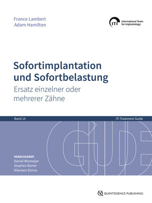 cover image of Sofortimplantation und Sofortbelastung